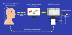 Neurofeedback | نوروفیدبک