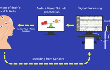 Neurofeedback | نوروفیدبک